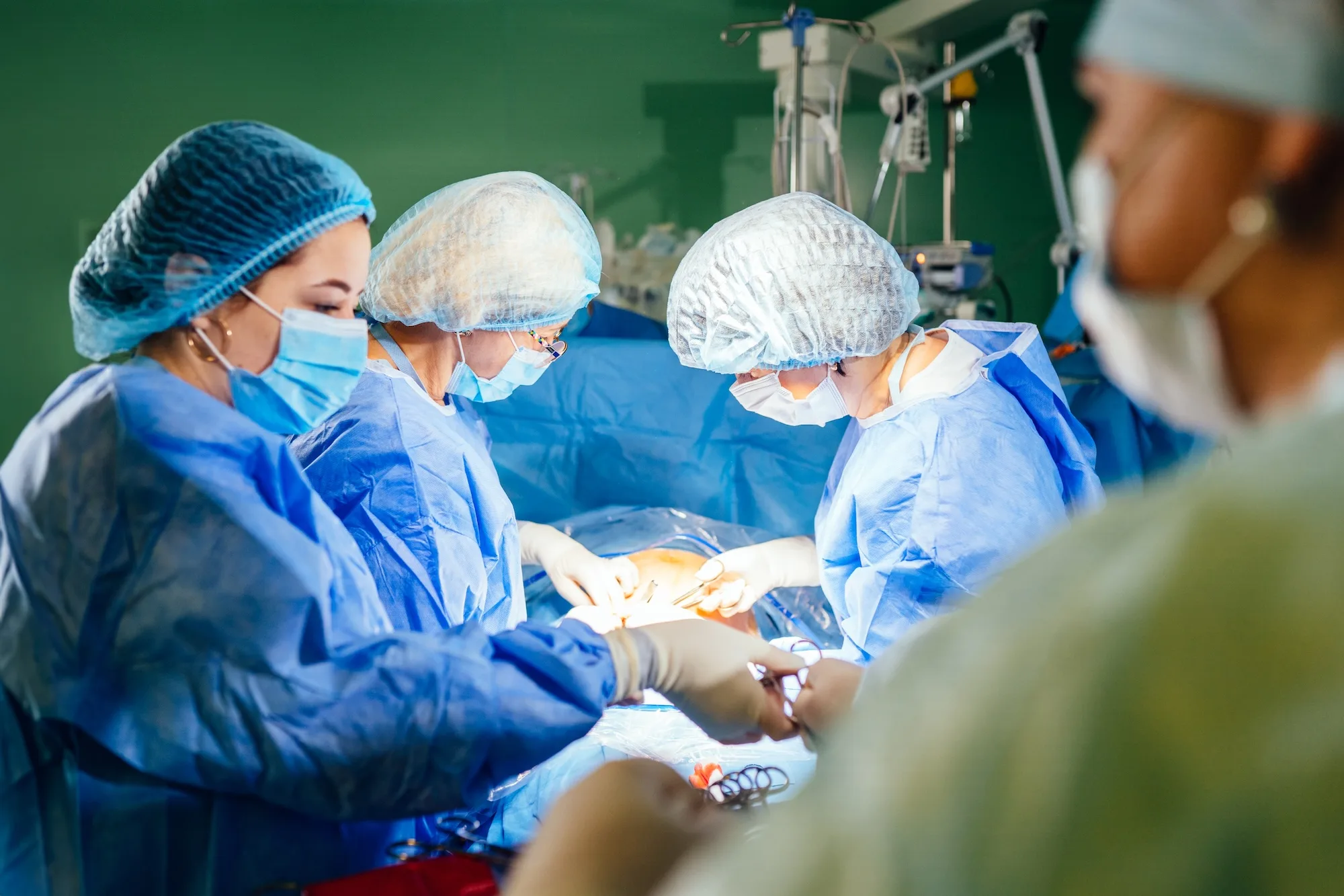 Geburtsvorbereitung Kaiserschnitt: Was es wirklich bringt und ob es sich lohnt